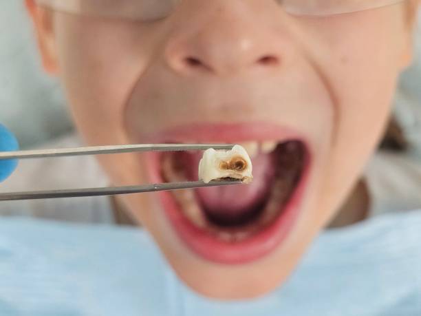 Best Emergency Care for Gum Disease in Kincaid, IL